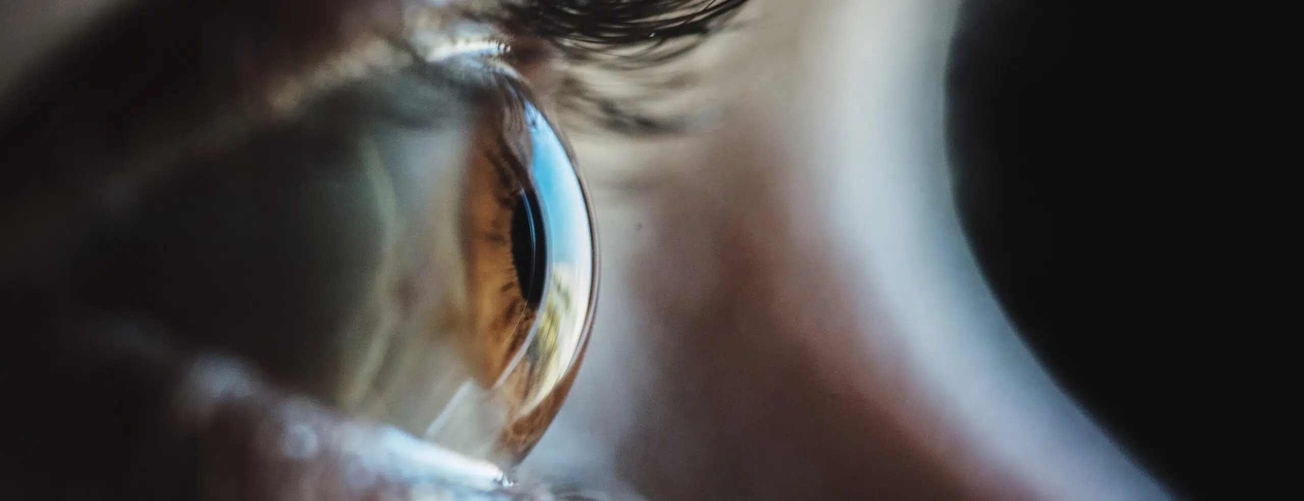 Mapping épithélial