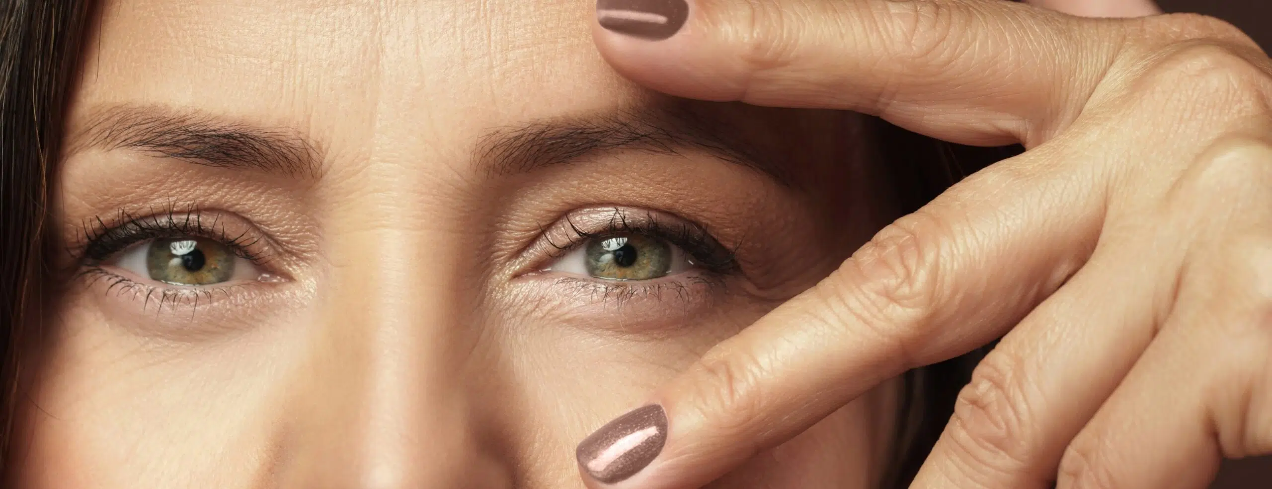 Ectasie cornéenne prévention Paris