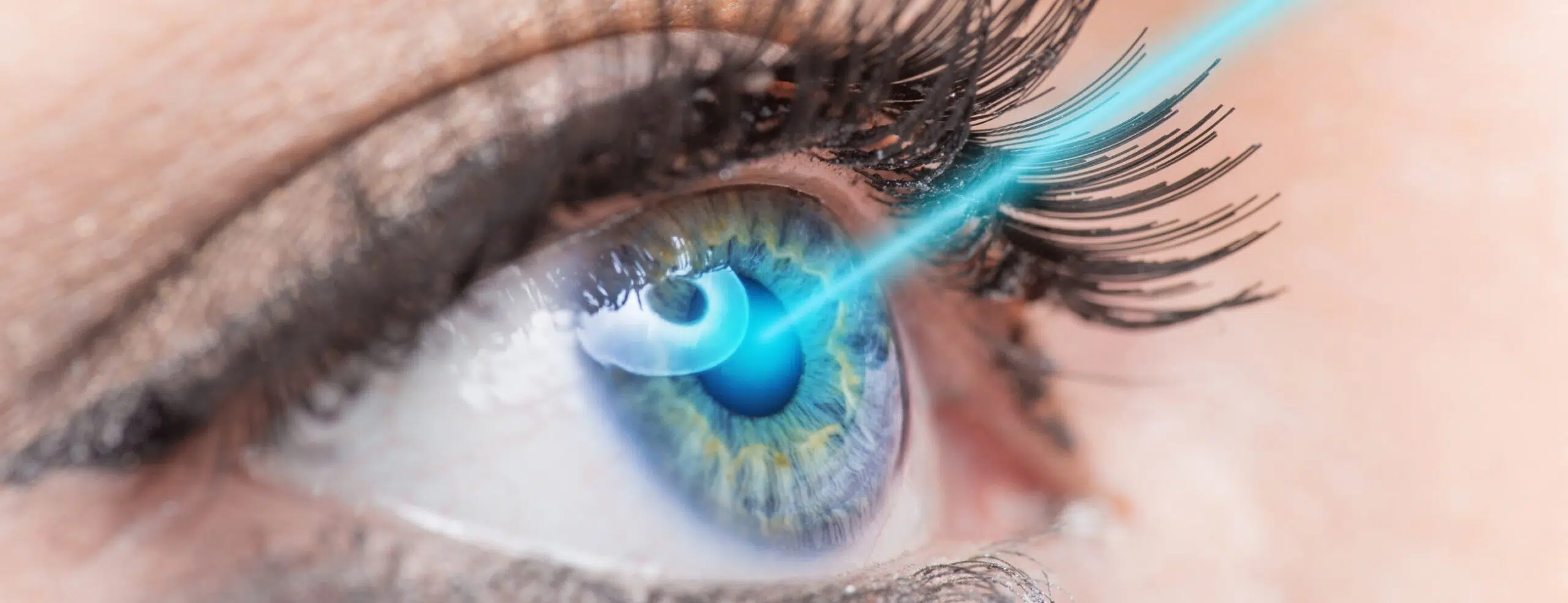 Presbylasik