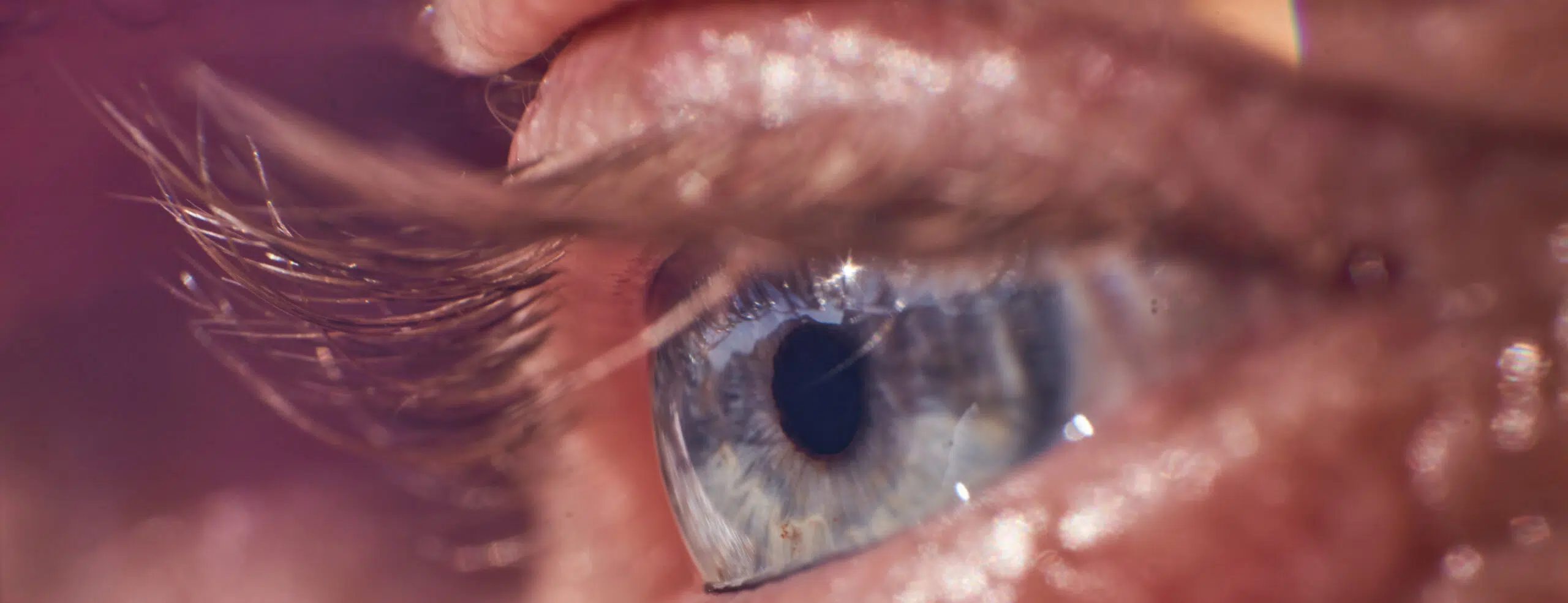 Choisir son implant de cataracte : critères médicaux et mode de vie