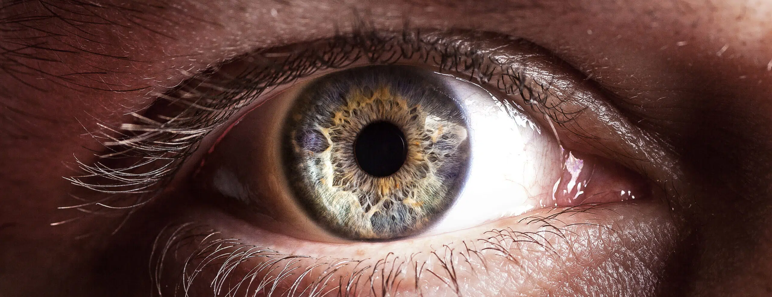 Quelle vision après une chirurgie de la cataracte ?