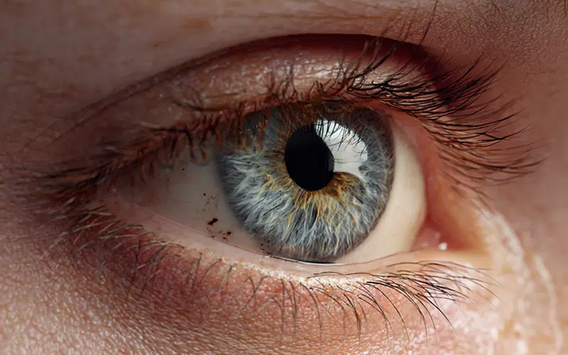 Corps étranger oeil | Dr Stacy Charpentier | Paris